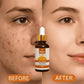 Vitamin C Face Serum 30ml | Brightening Anti-Aging & Hydrating Daily Skin Care Serum for Radiant Skin