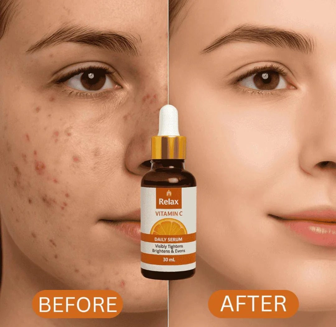Vitamin C Face Serum 30ml | Brightening Anti-Aging & Hydrating Daily Skin Care Serum for Radiant Skin